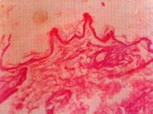 Opp. 150(C) Fig. 7 Group II C : No cream was applied for 2 months. The skin on the back of the body showed that epidermis was thin and infolded.