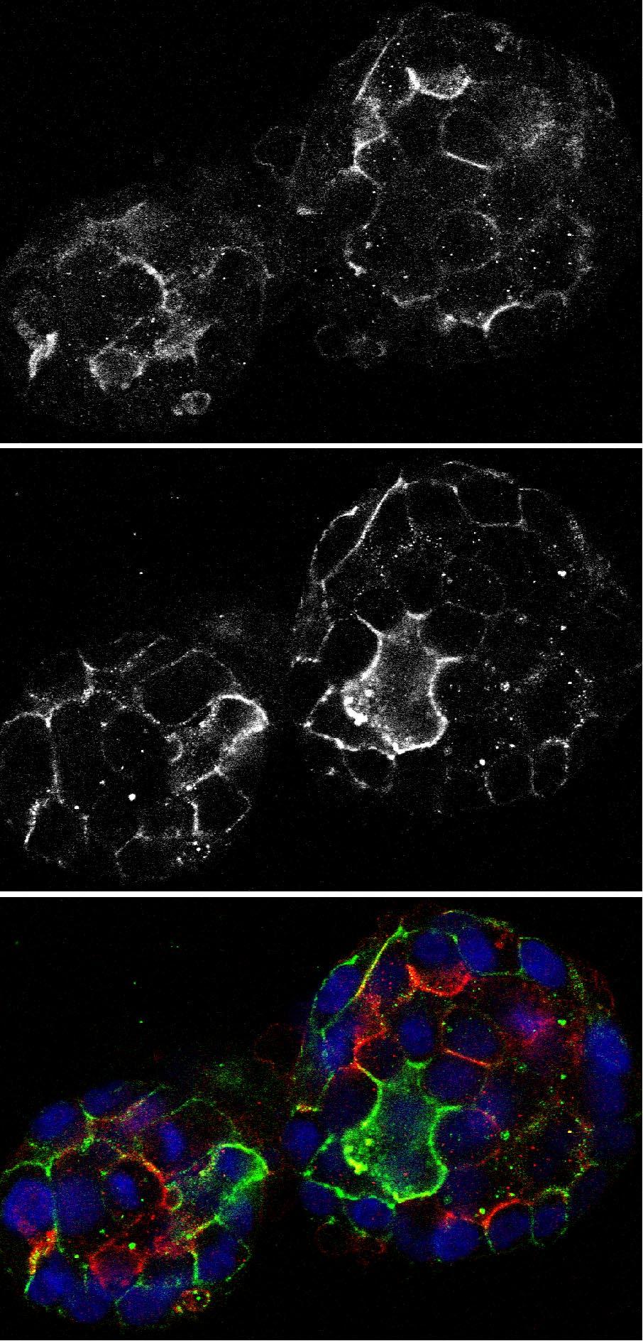 C554 of lumen formation and loss of cyst cell polarity.