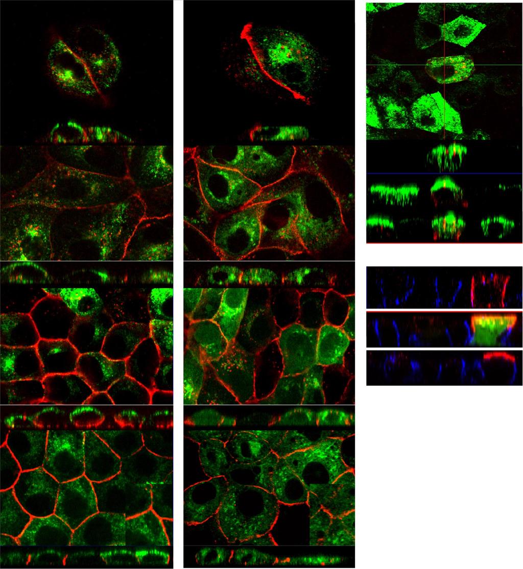 C550 Fig. 3. Trafficking and sorting of E-cad requires functional RE and Rab11. A and B: MDCK cells were stably transfected with either Rab11-GFP (A) or dominant-negative (DN)-Rab11-GFP (B).