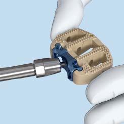 To prevent cross threading, ensure that the implant holder is perpendicular to the implant during engagement.