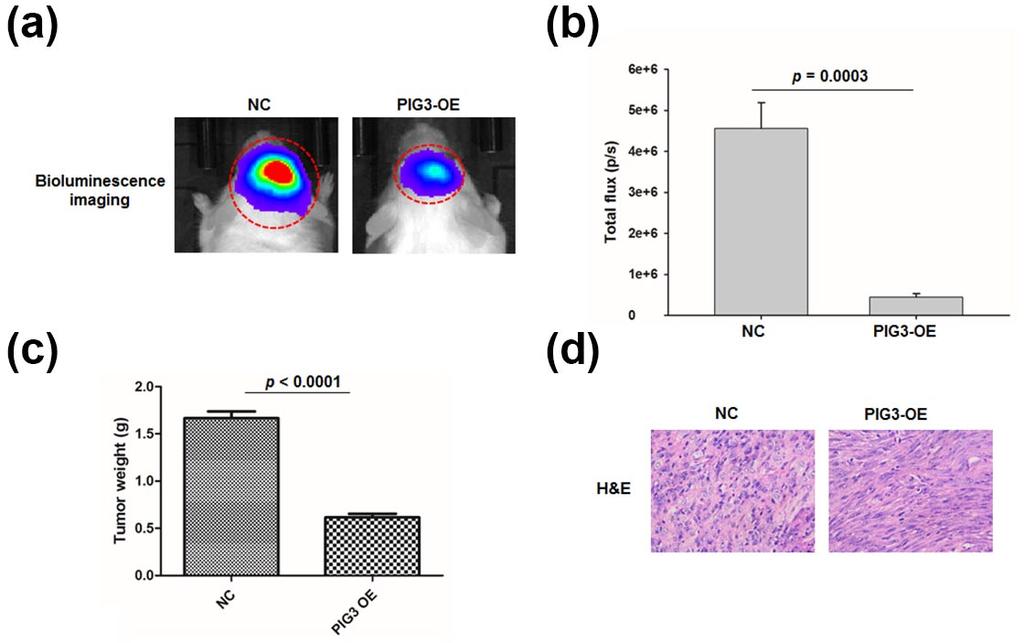 Quan et al. 7 Figure 4. Overexpression of PIG3 inhibits GBM progression in vivo.