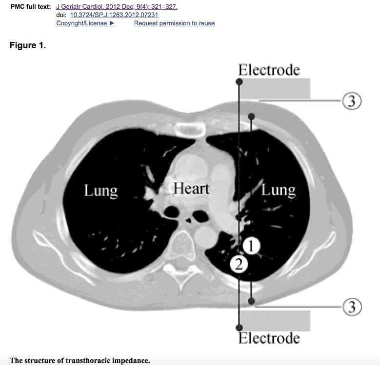 Derivation of baseline lung impedance in chronic heart
