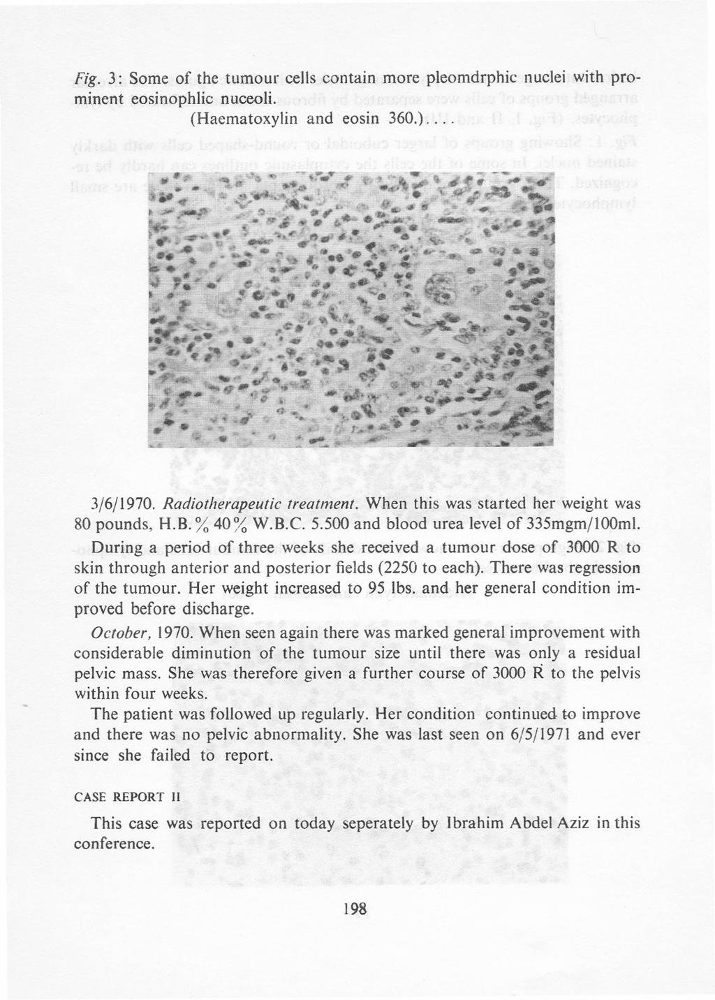 Fig. 3: Some of the tumour cells contain more pleorndrphic nuclei with prominent eosinophlic nuceoli. (Haematoxylin and eosin 360.)... 3/6/1970. Radiotherapeutic treatment.