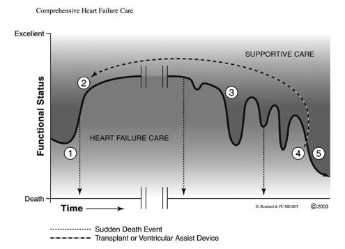 failure II Symptomatic with moderate exertion III Symptomatic with minimal exertion D Refractory heart failure requiring specialized interventions IV Symptomatic at rest Carvedilol is indicated for