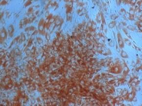 SHIELD AGAINST CELLULAR OXIDATIVE STRESS (I) Cell viability (%) Human dermal