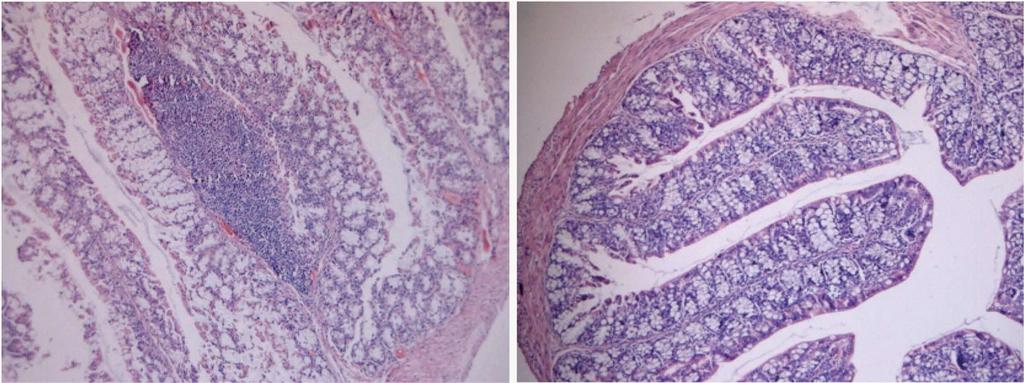 A B Figure 6 Representtive histologicl imges of colon smples from trinitroenzene sulfonic cid-induced colitis mice fed high dose Bifidocterium infntis.