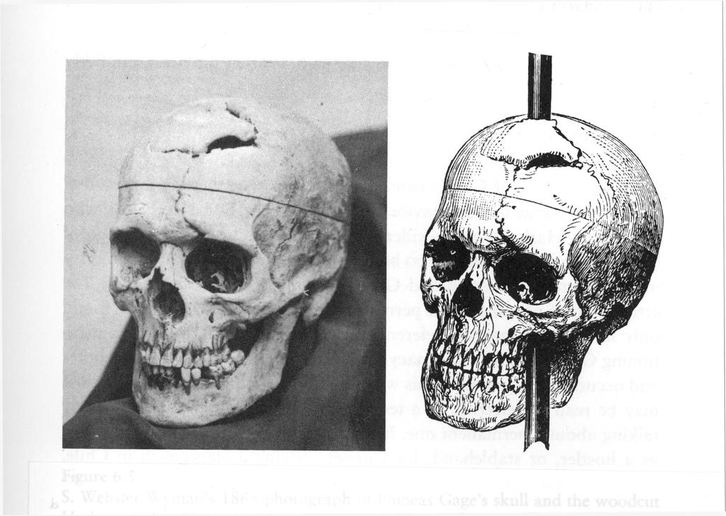 A Brief History Phineas Gage was a dynamite worker, and survived an