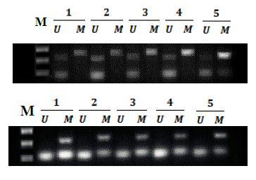 www.jbpe.org Figure 2: Examples of MSP reactions for promoter methylation analysis of ER in the control group and irradiated sample by cell phone.