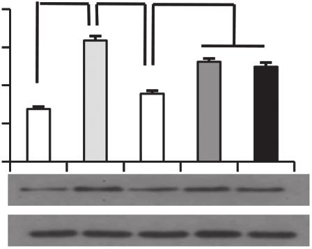 4 mmol/l) (5 ng/ml) L-NAME (5 µmol/l) SIS3 (3 µmol/l) Figure 4 reduced the plmitic cid-induced poptosis of MAECs.