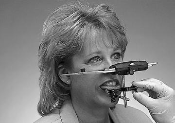 Adapting the clutches There are two ways to adapt the clutches for an intraoral condylar recording: 1) from mounted diagnostic casts, or 2) directly in the mouth.