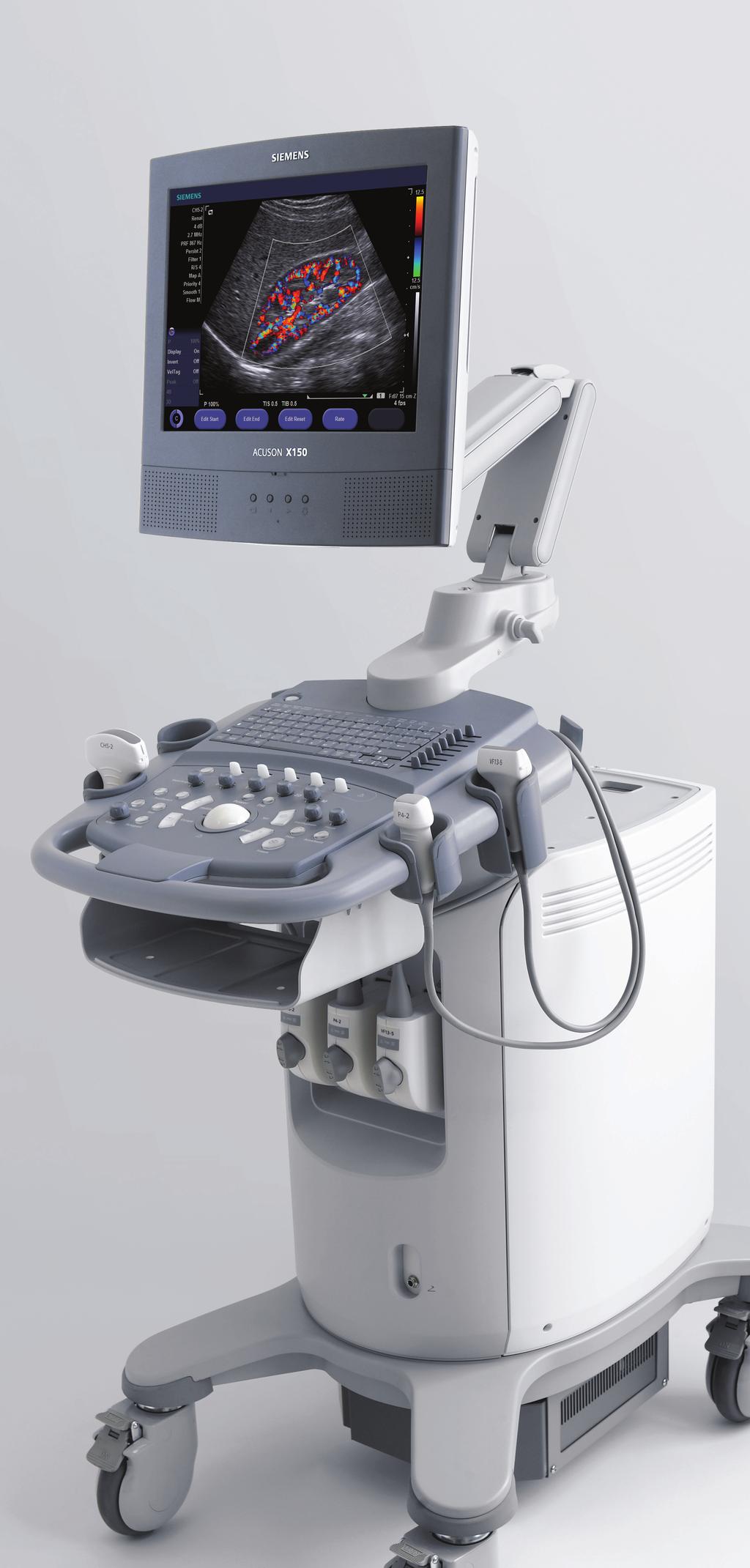 ACUSON X150 Ultrasound