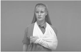 Shoulder Girdle Injuries Treatment Assess distal CSM Use sling and swathe Do not attempt to straighten or reduce Reassess distal CSM Forearm, Wrist, and Hand Injuries Signs Forearm: deformity and
