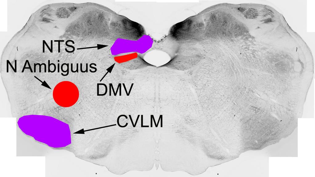 DMV dorsal motor nucleus of the vagus N Ambiguus nucleus