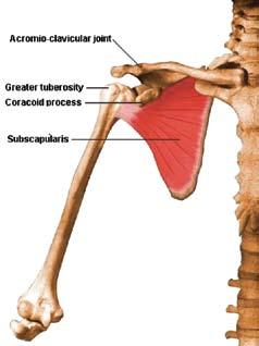 Calcifying Tendonitis: Sometimes prolonged inflammation can lead to buildup of calcium within the rotator cuff.