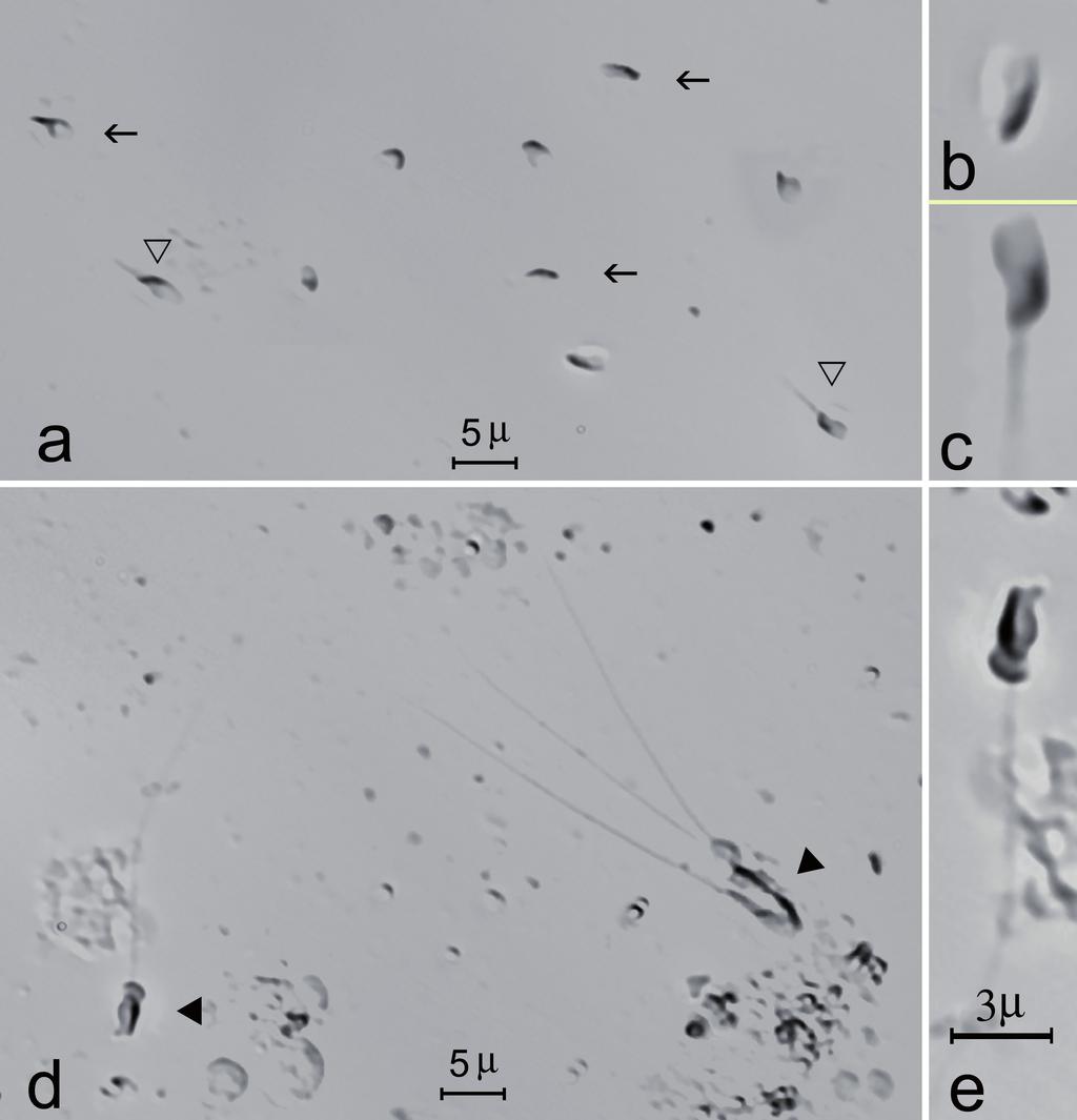 Figure 1 - Photomicrographs of wet preparations containing spermatozoa obtained by percutaneous epididymal sperm aspiration (PESA; a-c) and testicular sperm aspiration (TESA; d, e) from an infertile
