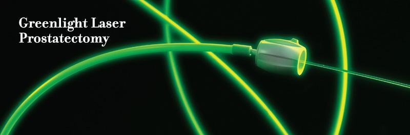 Laser powers up to 180W Uses side-fire fiber in non-contact
