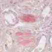 Tubercle bacilli and other acid-fast bacteria stain bright red and the background stains light green. Combined Eosinophil-Mast Cell Catalog No.