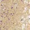 The argentaffin cells and melanin granules stain brown to black, while the nuclei stain pink. Giemsa Catalog No.
