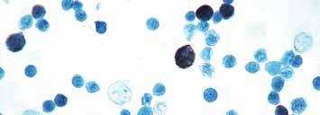 Adenovirus Clone: M58 + M73 Catalog No.: Mob 355 Concentrated 1ml Mob 355-05 Concentrated 0.5ml Regulatory Status: ASR Adrenocorticotropic Hormone (ACTH) Catalog No.
