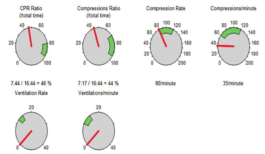 When complete filling of the CPR compression indicator has not been achieved due to diminished compression rate or depth, the E Series will display the letter R for rate and/or the letter D for depth