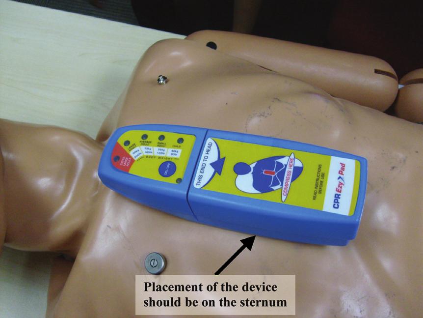 Singapore Med J 2011; 52(8) : 589 4a 4b Fig. 4 (a & b) Photographs show a pocket QCPR feedback device for use with manual CPR (CPREZY). arrest (IHCA).