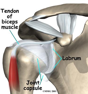 The soft labral tissue can be caught between the glenoid and the humerus. When this happens, the labrum may start to tear.