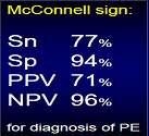 Regional rv dysfunction in acute PE McConell s