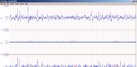 Sampling Frequency = 250 Hz Window width ~ 95sec EOG EMG EEG