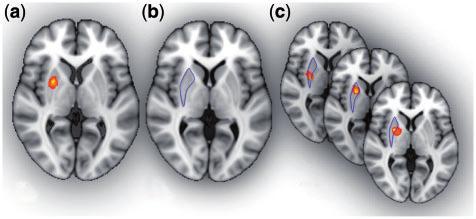 606 SCAN (2012) J. X. O Reilly et al. non-task-related explanations for the changes in the relationship between brain areas.