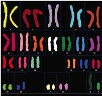 Chromosome Karyotype Fluorescent in situ Hybridization (FISH) Comparative Genome Hybridization (CGH) 3.