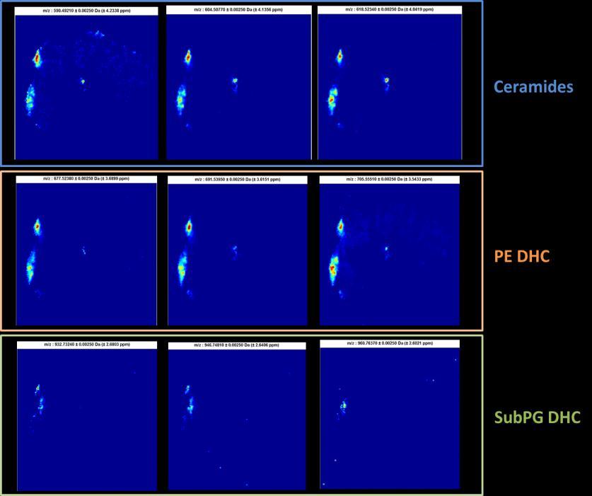 c) Single ion images for homologous ceramides (top), phosphoethanolamine dihydroceramides (middle) and
