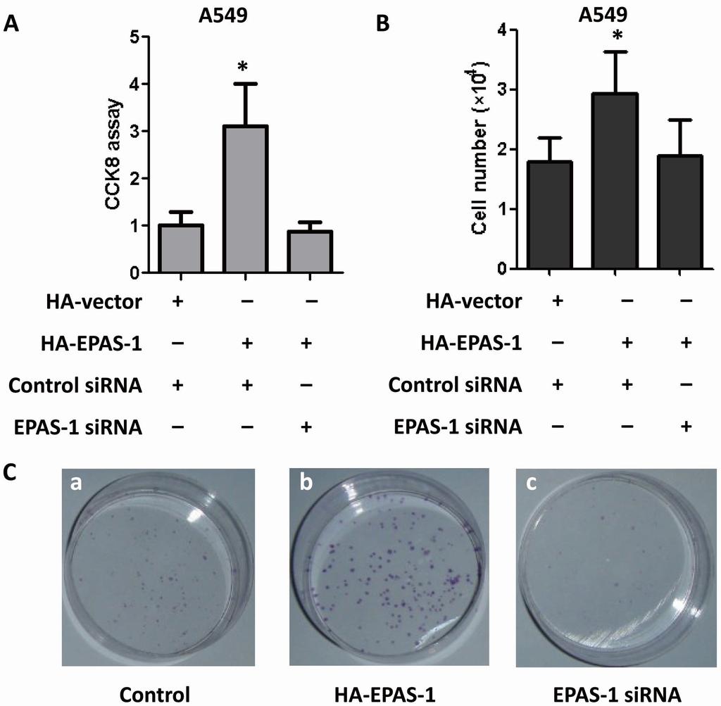 Int. J. Mol. Sci. 2014, 15 15695 reduced the colony number (Figure 5C). Those data indicated that EPAS-1 plays an important role in human lung adenocarcinoma cell survival and proliferation. Figure 5.