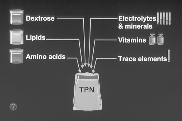 Is Peripheral Vein (PPN) or central vein nutrition (TPN) most appropriate? Are there pre-existing existing electrolyte abnormalities? What are the caloric requirements?
