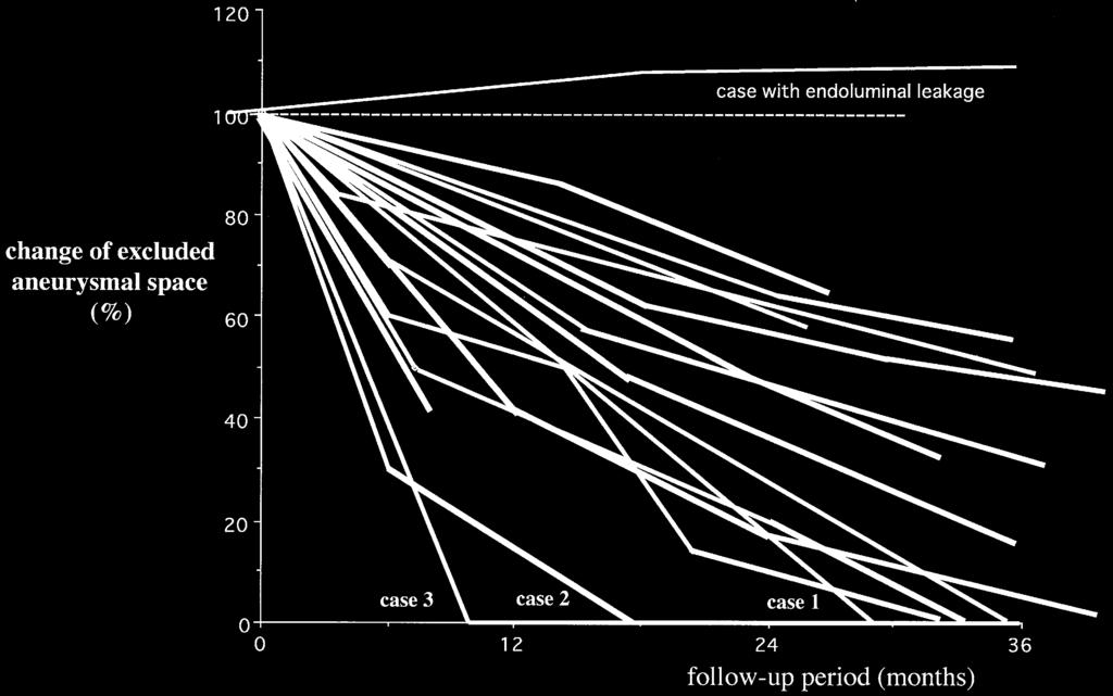 Ann Thorac Surg SUEDA ET AL 2003;76:84 9 FATE OF ANEURYSMS AFTER STENT-GRAFTING 87 Fig 4. Changes in the excluded aneurysmal space.