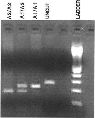 JACC Vol. 33, No. 3, 1999 March 1, 1999:727 33 Anderson et al. Glycoprotein IIIa Polymorphism and MI Risk 729 Figure 1.