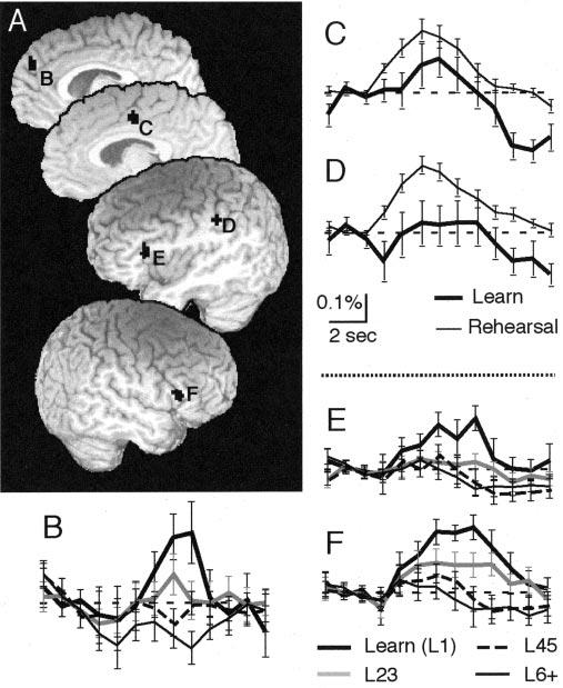 Eliassen et al. Visual Motor Associative Learning J. Neurosci., November 19, 2003 23(33):10540 10547 10545 Figure 8. Activation comparing rehearsing the association and movement.