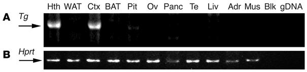 Figure 1 Transgene tissue expression. (A) SYN-LEPR-B transgene expression analysis in several tissues of Syn-db3J/db3J mice.