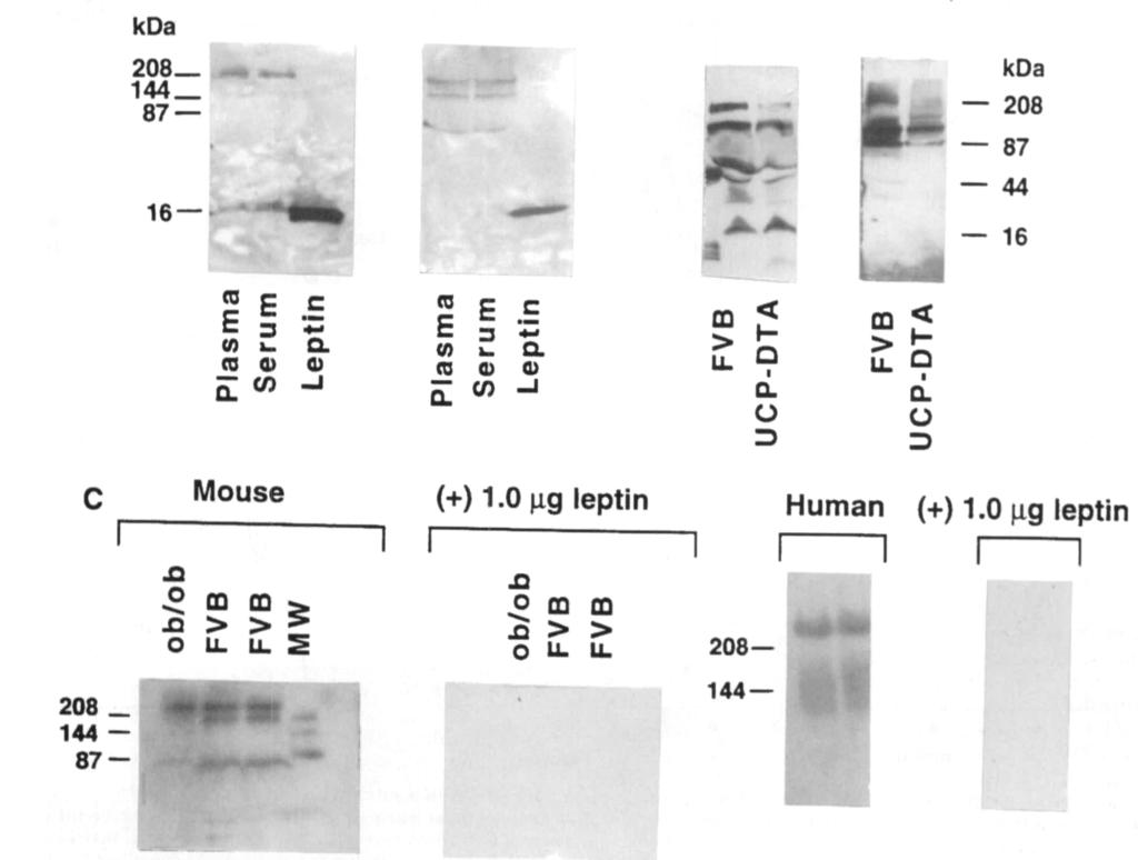 K.L. HOUSEKNECHT AND ASSOCATES A kda 208 144 87 16 (+)BME (-)BME B (+)BME a uj 1 (-)BME 1 1 L ft r i kda 208 87 44 16 rood) 2 E Q. a a> FVB UCP-DTA FVB UCP-DTA Mouse (+) 1.0 n,g leptin Human (+) 1.