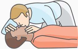 3) Give Rescue Breaths Remove anything in mouth Make sure airway is clear Place 1 hand on chin, tilt head back Pinch nose