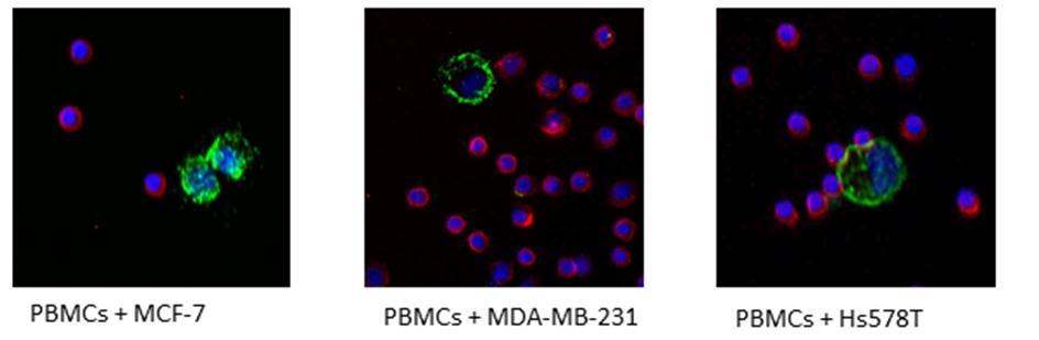 using flow cytometry. VAR2CSA showed no binding to the PBMCs whereas it bound to the MCF-7, MDA-MB-231 and Hs578T cell lines, confirming the cancer specificity.