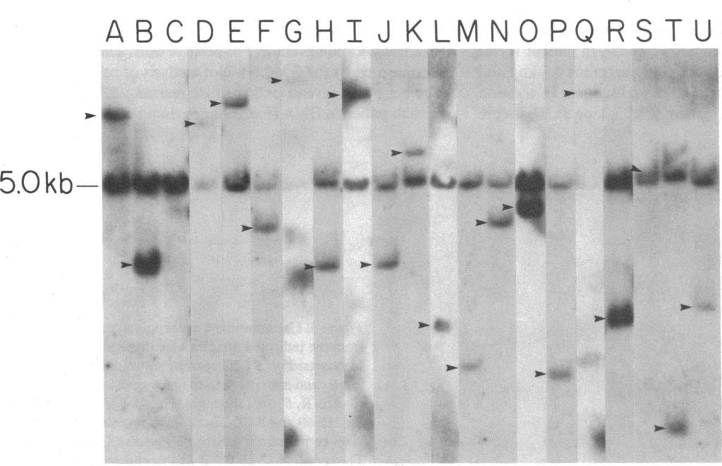 DNA was extracted from the isolated leukocytes by digesting nuclei with protease K, then phenol/chloroform extracting and ethanol precipitating, as previously described (17).