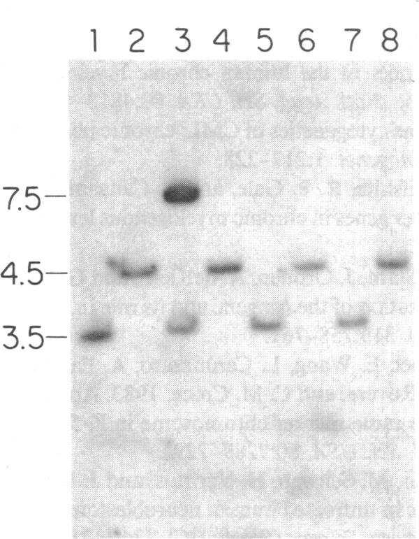 We were particularly interested in determining the breakpoint locations on chromosome 9, since initial reports indicated that these breaks occurred at a variable distance from the 5' end of the c-abl