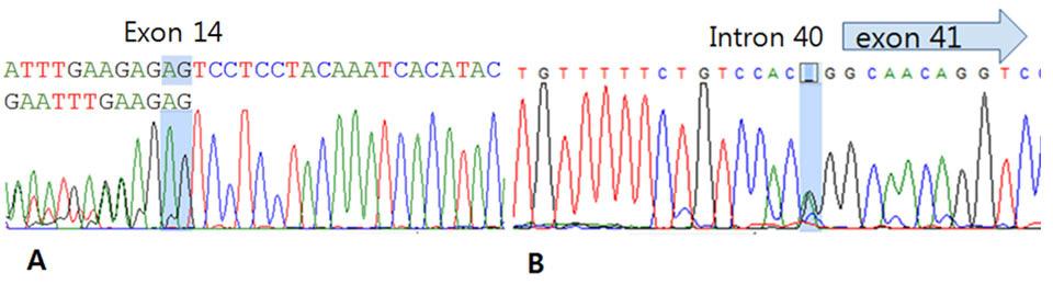 176 Young-Mi Han, et al. A Case of MDCMD with Cortical Abnormalities Figure 4. The compound heterozygous mutation for c.2049_2050delag (p.r683fs) and c.