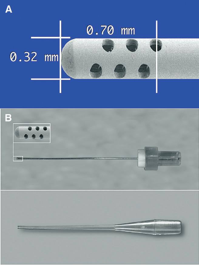 (B) The macrocannula attached to its handle used for initial flushing of the coronal portion of the canal. (C) The microcannula attached to its handle.