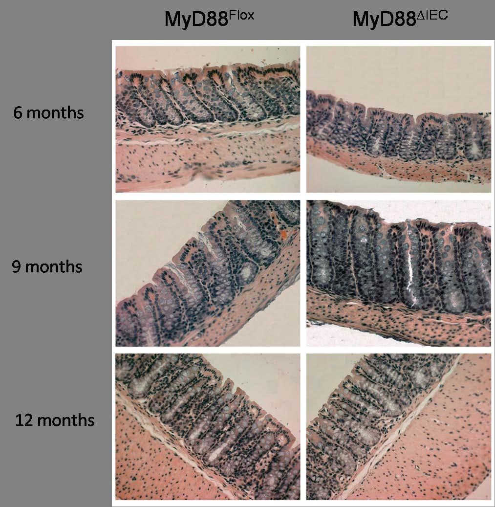 Figure 5-2 MyD88 IEC mice do not develop spontaneous colitis with age.