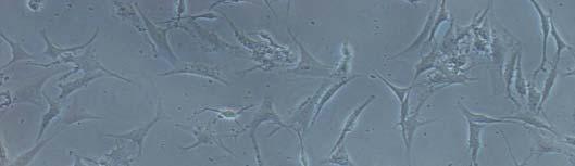 Effect of mesenchymal stem cells on
