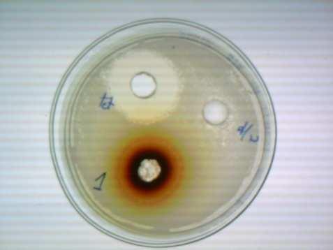 Figure 1: Antibiogram of