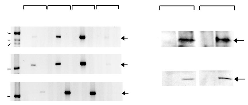 few egfp-positive cells in LH (Fig. 2c). In contrast, pro-opiomelanocortin (POMC) expression in ARH responded normally to fasting in CA-AMPK-expressing mice.
