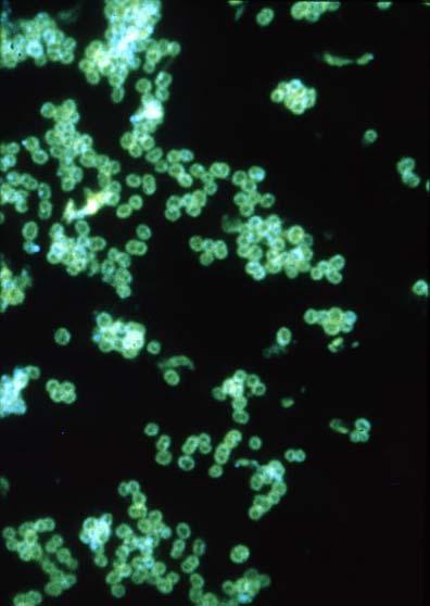 Fluorescent Antibody Stain