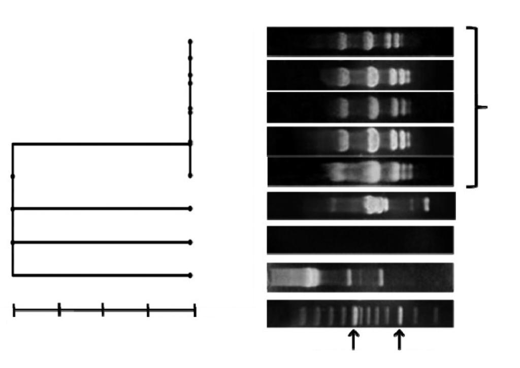 K. pneumoniae highly-resistant to Carbapenems The Open Microbiology Journal, 2017, Volume 11 157 Fig. (2). Random Amplified Polymorphic DNA (RAPD) of K. pneumoniae isolates resistant to carbapenems.